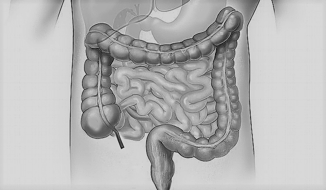 Intestinale revalidatiepreparaten